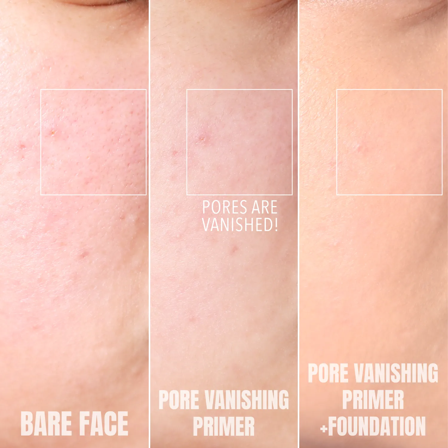 Complete Pore Vanishing Primer